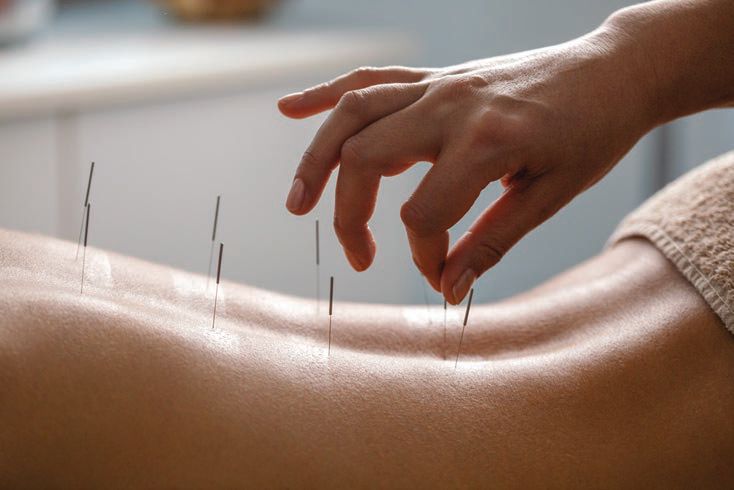 Snyder specializes in acupuncture at Moon Rabbit ACUPUNCTURE PHOTO BY MILJKO/ISTOCK