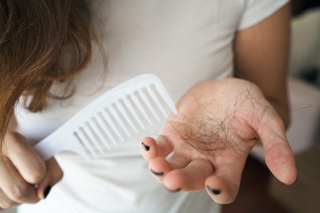 woman-losing-hair-on-hairbrush-in-hand-picture-id1054464860.jpg